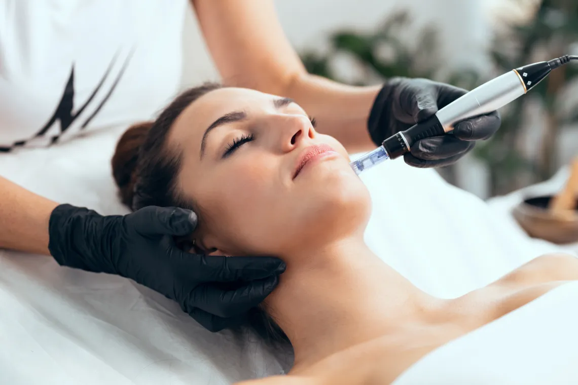 Microneedling Dortmund Behandlung